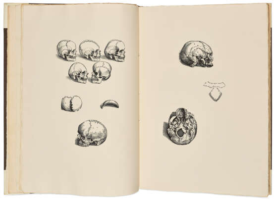 Vesalius's Icones anatomicae - Foto 3