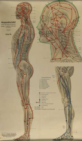 Akupunkturtafel - фото 7