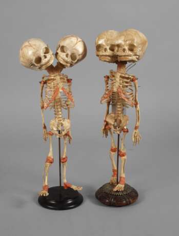 Zwei anatomische Modelle - Foto 1