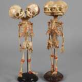 Zwei anatomische Modelle - Foto 1