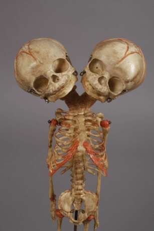 Zwei anatomische Modelle - Foto 4