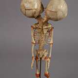 Zwei anatomische Modelle - Foto 5