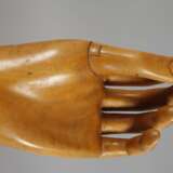 Handprothese - photo 2