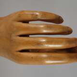 Handprothese - photo 3
