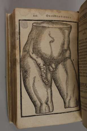 Zwei Erstausgaben Wilhelm Fabry 1606 - Foto 5