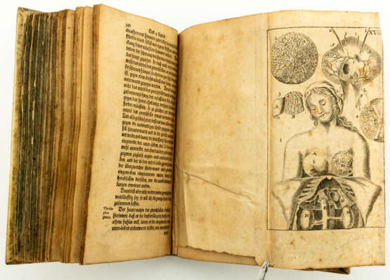 Verheyn, Philipp: Anatomie oder Zerlegung des menschlichen Leibes, ... - фото 2