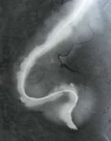 Helmut Schober (Innsbruck 1947). Schwingungen VI.