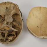 Anatomisches Lehrmodell - Foto 4