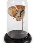 Divers objets anciens. Anatomisches Modell