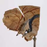 Anatomisches Modell - photo 2