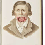 AUVERT, Alexander Ivanovich (d.1865) - photo 4