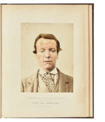 SQUIRE, Alexander Balmanno (1836-1908)