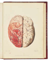 BRIGHT, Richard (1789-1858)