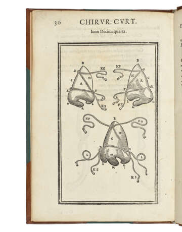 TAGLIACOZZI, Gaspare (1545-1599) - фото 3