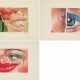 Fritz Köthe. Mixed Lot of 3 Prints - photo 1