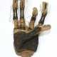 Antike Handprothese, - photo 1