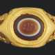 A ROMAN GOLD AND BANDED AGATE FINGER RING - photo 1