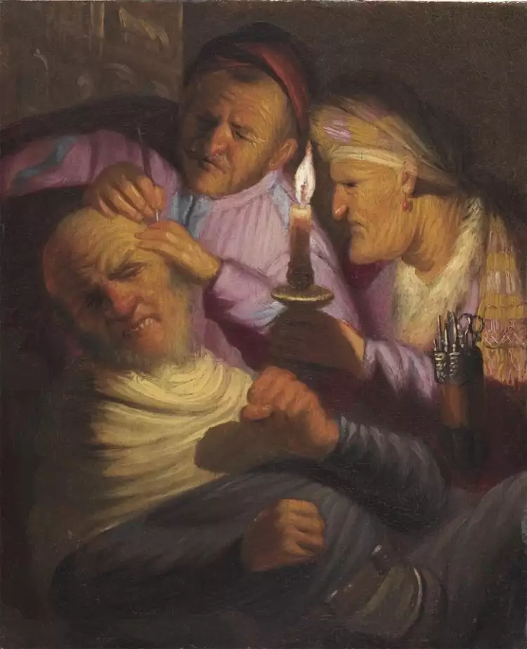 Неудачные работы художников. Операция с камнем, Рембрандт