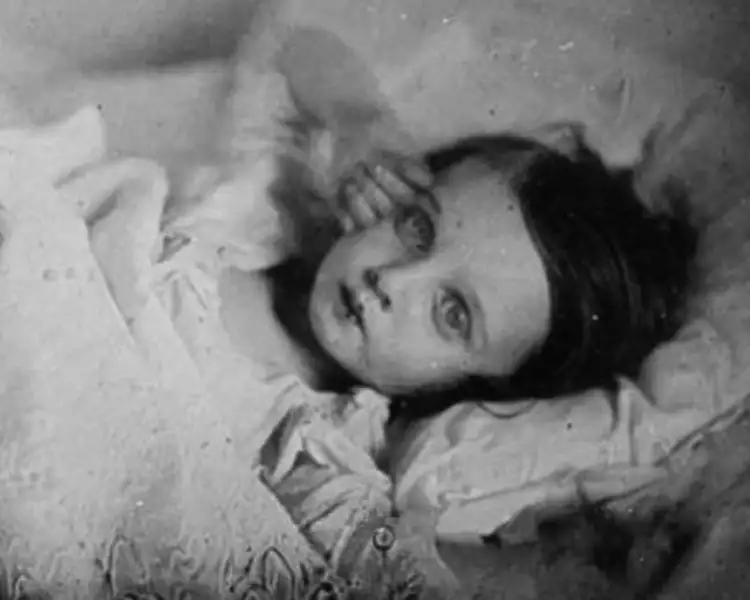 Постмортем. Умершая девочка Постмортем. Умершая девочка