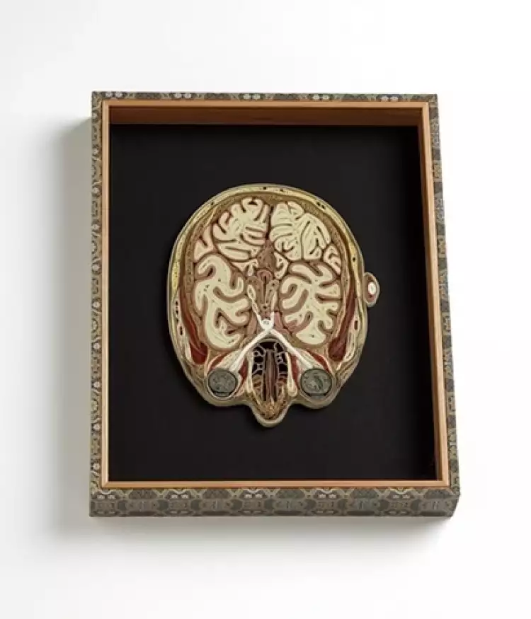 Лиза Нильссон. Голова